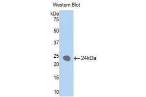 Western Blotting (WB) image for anti-Keratin 1 (KRT1) (AA 350-488) antibody (ABIN1172987) (Cytokeratin 1 antibody  (AA 350-488))