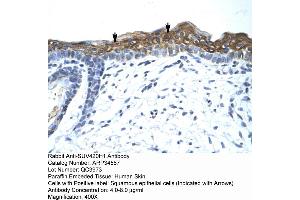 Rabbit Anti-SUV420H1 Antibody  Paraffin Embedded Tissue: Human Skin Cellular Data: Squamous epithelial cells Antibody Concentration: 4. (SUV420H1 antibody  (Middle Region))