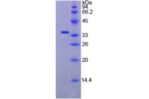 SDS-PAGE of Protein Standard from the Kit (Highly purified E. (E-cadherin CLIA Kit)