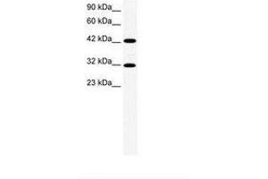 Image no. 1 for anti-General Transcription Factor IIH, Polypeptide 2, 44kDa (GTF2H2) (AA 299-348) antibody (ABIN202422) (GTF2H2 antibody  (AA 299-348))