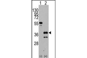 Western blot analysis of ZIC4 (arrow) using rabbit polyclonal ZIC4 Antibody (C-term) (ABIN389183 and ABIN2839346). (ZIC4 antibody  (C-Term))