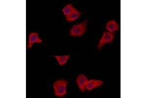 ABIN6265998 and ABIN6273087 staining HepG2 by IF/ICC. (VPS37A antibody  (N-Term))