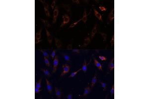 Immunofluorescence analysis of C6 cells using VPS25 Polyclonal Antibody (ABIN6128913, ABIN6150122, ABIN6150123 and ABIN6217011) at dilution of 1:100 (40x lens).