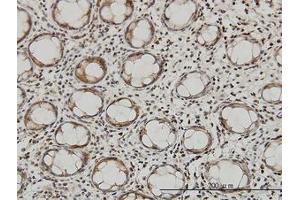 Image no. 4 for anti-Glutaminyl-tRNA Synthetase (QARS) (AA 677-776) antibody (ABIN598566) (QARS antibody  (AA 677-776))
