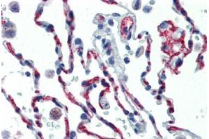 Human Lung (formalin-fixed, paraffin-embedded) stained with CD34 antibody ABIN461990 at 1:50 followed by biotinylated anti-mouse IgG secondary antibody ABIN481714, alkaline phosphatase-streptavidin and chromogen. (CD34 antibody  (FITC))