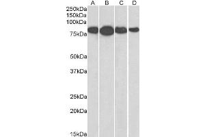 ABIN2564861 (0. (Radixin antibody  (Internal Region))