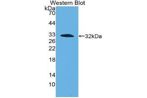 Detection of Recombinant TF, Mouse using Polyclonal Antibody to Tissue Factor (TF) (Tissue factor antibody  (AA 30-251))