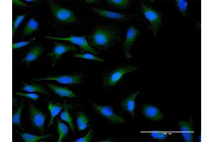 Immunofluorescence of purified MaxPab antibody to C19orf10 on HeLa cell. (C19orf10 antibody  (AA 1-173))
