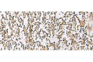Immunohistochemistry of paraffin-embedded Human tonsil tissue using ZPBP2 Polyclonal Antibody at dilution of 1:80(x200)