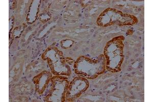 IHC image of ABIN7150833 diluted at 1:200 and staining in paraffin-embedded human kidney tissue performed on a Leica BondTM system. (DNM2 antibody  (AA 640-1119))