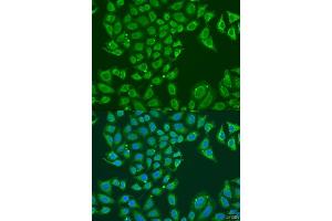 Immunofluorescence analysis of U2OS cells using B1 antibody (ABIN7265534) at dilution of 1:100. (ALDH1B1 antibody  (AA 278-517))