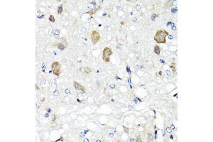 Immunohistochemistry of paraffin-embedded rat brain using RBP2 antibody (ABIN5974059) at dilution of 1/100 (40x lens). (RBP2 antibody)