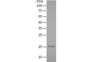 Septin 7 Protein (SEPT7) (AA 76-227) (His tag)