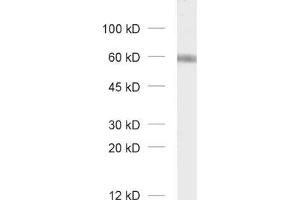 dilution: 1 : 1000, sample: unboiled synaptic membrane fraction of rat brain (LP1) (GABRA3 antibody  (AA 29-43))