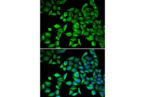 Immunofluorescence analysis of HeLa cells using CRP antibody. (CRP antibody)