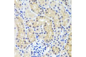 Immunohistochemistry of paraffin-embedded mouse kidney using INADL antibody at dilution of 1:100 (x40 lens). (PATJ antibody)