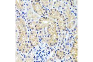 Immunohistochemistry of paraffin-embedded mouse kidney using INADL antibody at dilution of 1:100 (x40 lens). (PATJ antibody)