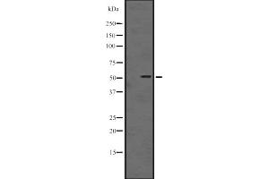 Western blot analysis of IRAK4 expression in A431 whole cell lysate ,The lane on the left is treated with the antigen-specific peptide. (IRAK4 antibody  (Internal Region))