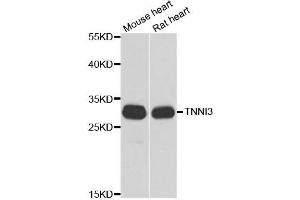 Western blot analysis of extracts of various cell lines, using TNNI3 antibody. (TNNI3 antibody)