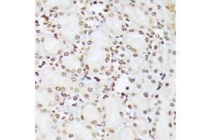 Immunohistochemistry of paraffin-embedded rat kidney using Phospho-c-Abl-Y412 antibody (ABIN7265966) at dilution of 1:100 (40x lens). (ABL1 antibody  (pTyr412))