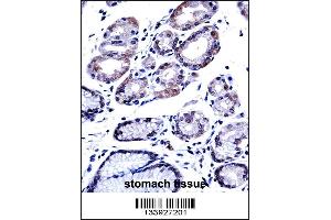 G3BP1 Antibody immunohistochemistry analysis in formalin fixed and paraffin embedded human stomach tissue followed by peroxidase conjugation of the secondary antibody and DAB staining. (G3BP1 antibody  (C-Term))