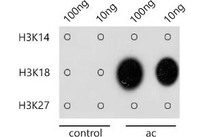 Dot-blot analysis of all sorts of methylation peptides using Acetyl-Histone H3-K18 antibody (ABIN7267668) at 1:1000 dilution. (Histone 3 antibody  (H3K18))