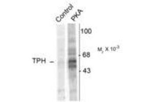 Image no. 1 for anti-Tryptophan Hydroxylase 1 (TPH1) (pSer58) antibody (ABIN227714) (Tryptophan Hydroxylase 1 antibody  (pSer58))