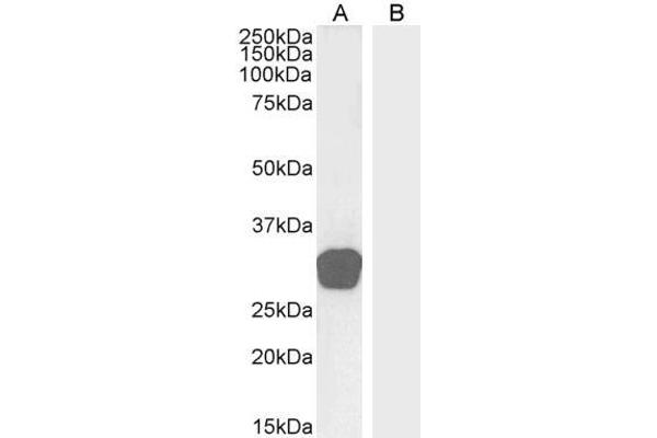 GDF15 anticorps  (C-Term)