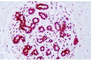 Image no. 3 for anti-Histone H3 (H3) (H3K18ac) antibody (ABIN2879163) (Histone 3 antibody  (H3K18ac))