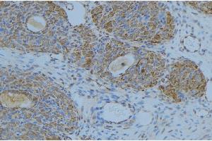 ABIN6276676 at 1/100 staining Human uterus tissue by IHC-P. (LIPC antibody  (Internal Region))