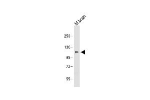 Anti-OTUD7A Antibody (N-term) at 1:1000 dilution + Mouse brain lysate Lysates/proteins at 20 μg per lane. (OTUD7A antibody  (N-Term))