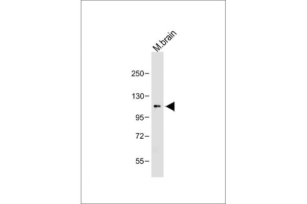 OTUD7A antibody  (N-Term)