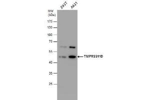 WB Image TMPRSS11D antibody detects TMPRSS11D protein by western blot analysis. (TMPRSS11D antibody  (Center))
