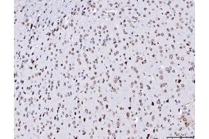 IHC analysis of TPR using anti-TPR antibody (ABIN7603243).