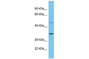 Host: Rabbit Target Name: OR2A25 Sample Type: Placenta lysates Antibody Dilution: 1. (OR2A25 antibody  (C-Term))