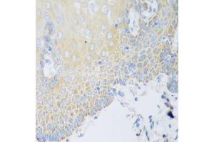 Immunohistochemistry of paraffin-embedded human esophagus using DHODH antibody. (DHODH antibody  (AA 116-395))