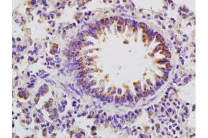 Formalin-fixed and paraffin embedded rat lung labeled with Rabbit Anti-Defensin beta2 Polyclonal Antibody, Unconjugated (ABIN2173551) at 1:200 followed by conjugation to the secondary antibody and DAB staining (beta 2 Defensin antibody  (AA 21-71))