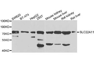 Western blot analysis of extracts of various cell lines, using SLC22A11 antibody. (SLC22A11 antibody  (AA 40-150))
