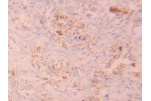 Detection of FGFR1 in Human Ovary Tissue using Polyclonal Antibody to Fibroblast Growth Factor Receptor 1 (FGFR1) (FGFR1 antibody  (AA 236-362))