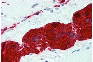 Human Small Intestine, Myenteric Plexus: Formalin-Fixed, Paraffin-Embedded (FFPE) (UCHL1 antibody  (AA 1-224))