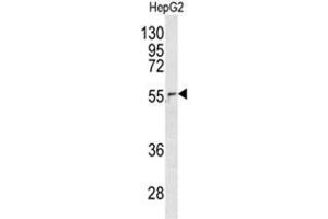 Western blot analysis of NUP62 antibody (C-term E507) in HepG2 cell line lysates (35ug/lane). (NUP62 antibody  (C-Term))