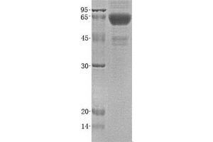 Validation with Western Blot (RTN4R Protein (His tag))