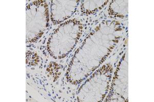 Immunohistochemistry of paraffin-embedded human colon using AKAP8 antibody (ABIN5975842) (40x lens). (AKAP8 antibody)