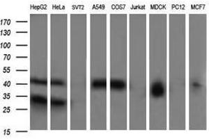Image no. 4 for anti-Parvin, alpha (PARVA) antibody (ABIN1496446)