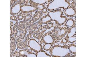 IHC analysis of Annexin A10/ANXA10 using anti-Annexin A10/ANXA10 antibody (ABIN7601853).