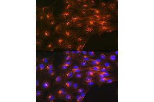 Immunofluorescence analysis of C6 cells using Cation-independent Cation-independent M6PR (IGF2R) (IGF2R) Rabbit mAb (ABIN1678848, ABIN3018066, ABIN3018067 and ABIN7101574) at dilution of 1:100 (40x lens). (IGF2R antibody)