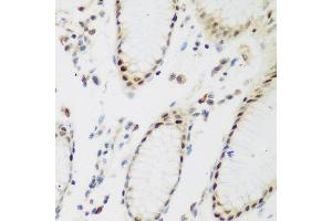 Immunohistochemistry of paraffin-embedded human gastric using PPAN antibody at dilution of 1:200 (40x lens). (PPAN antibody)