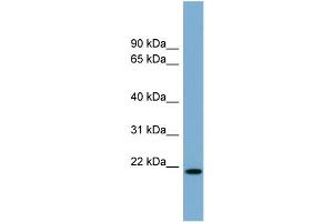WB Suggested Anti-CYBA Antibody Titration:  0.