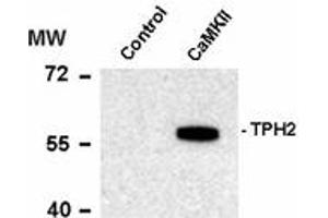 Image no. 1 for anti-Tryptophan Hydroxylase 1 (TPH1) (pSer19) antibody (ABIN303965) (Tryptophan Hydroxylase 1 antibody  (pSer19))