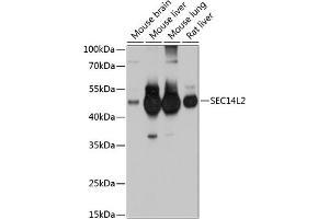 Western blot analysis of extracts of various cell lines, using SEC14L2 antibody (ABIN6132639, ABIN6147484, ABIN6147485 and ABIN6214889) at 1:1000 dilution. (SEC14L2 antibody  (AA 60-270))